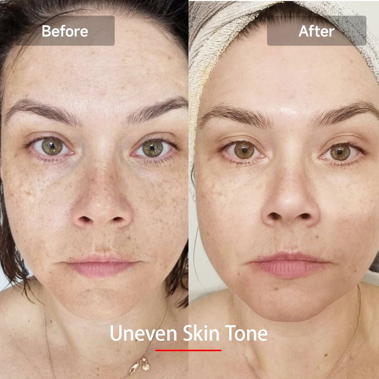 LED Red Light Therapy Mask